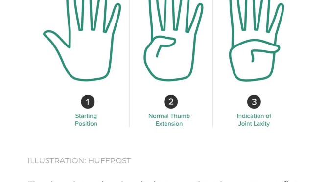 Book sales, thumbs and runaway greenery.