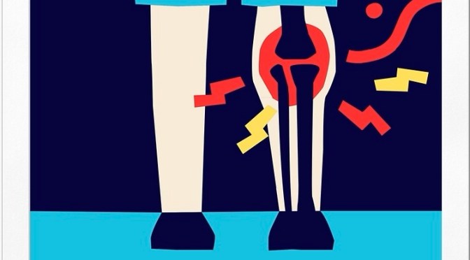 I knee’d some advice.